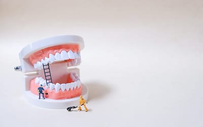 Perawatan Saluran Akar / Perawatan Syaraf Gigi / Root Canal Treatment